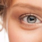 درمان پف چشم + بهترین راه حل